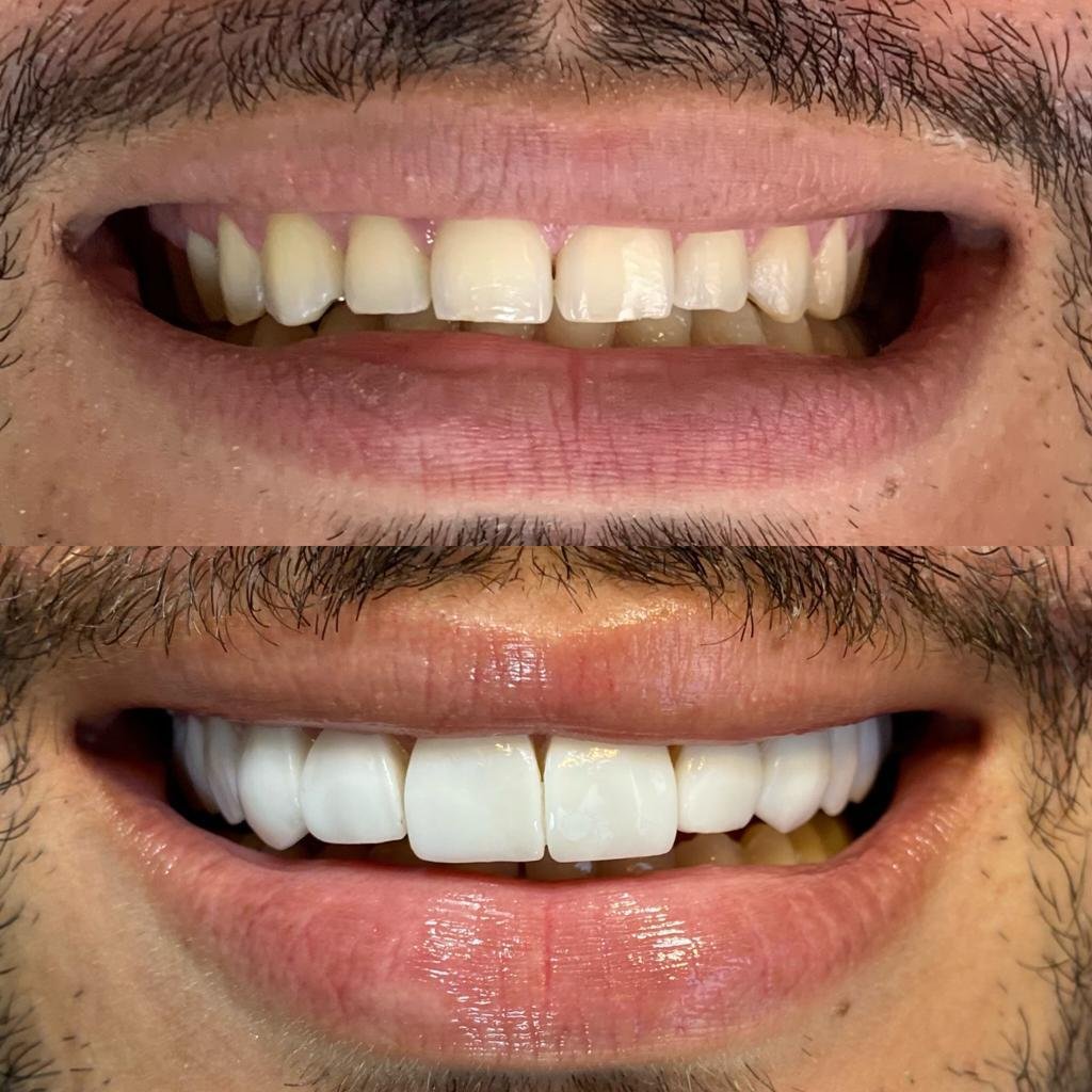 WhatsApp Image 2025-06-13 at 15.37.40