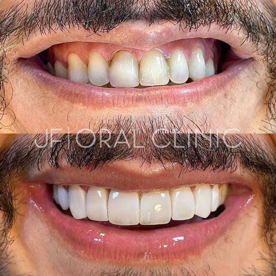 WhatsApp Image 2025-06-13 at 15.37.55